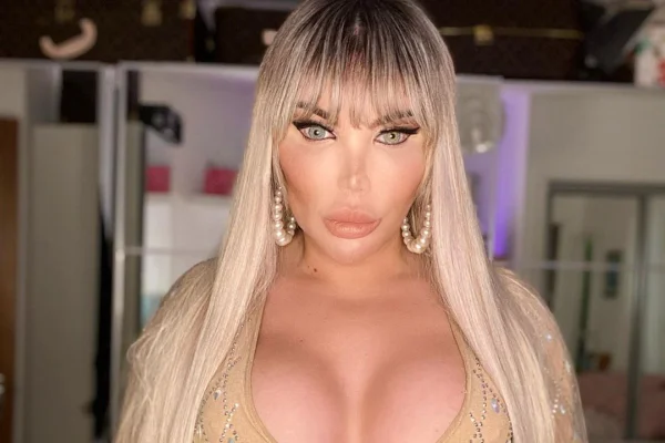 Jessica Alves passa por mais uma cirurgia no nariz: “Respirar melhor”