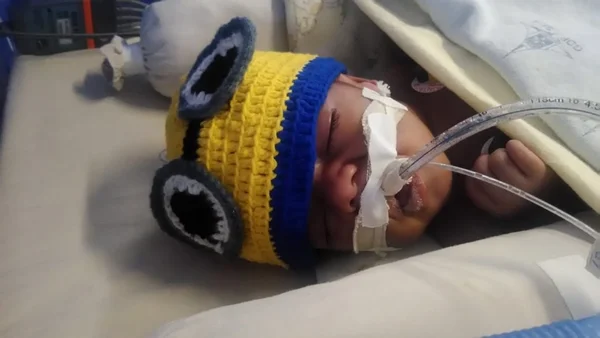 Bebê morre após esperar dois meses por cirurgia cardíaca