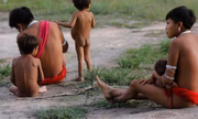 Crianças indígenas Yanomami ficaram sem medicamentos para combater verme