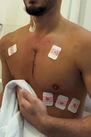 Vittor Fernando publicou registros do hospital e do carro atingido após atentado