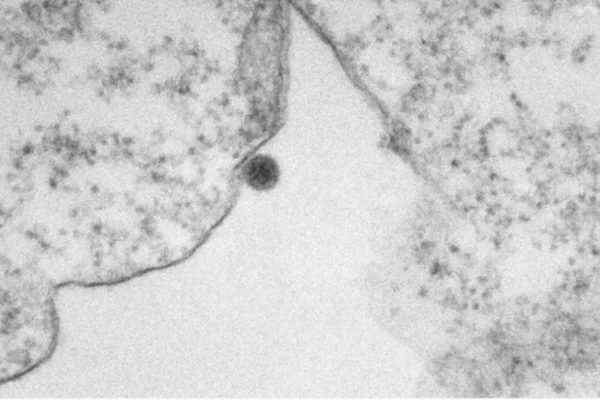 Partícula do vírus Oropouche registrada em microscopia eletrônica de transmissão. Metrópoles