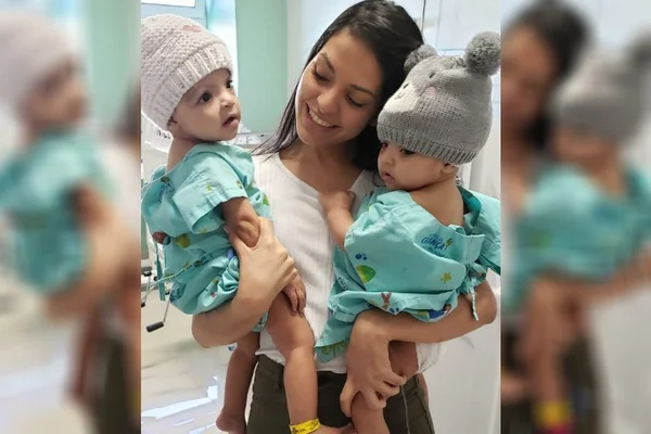 Mel e Lis, siamesas separadas em cirurgia, ganham festa de aniversário