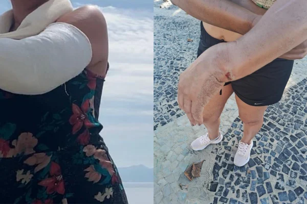 “Me custou duas cirurgias”, diz turista indenizada após seguro negado