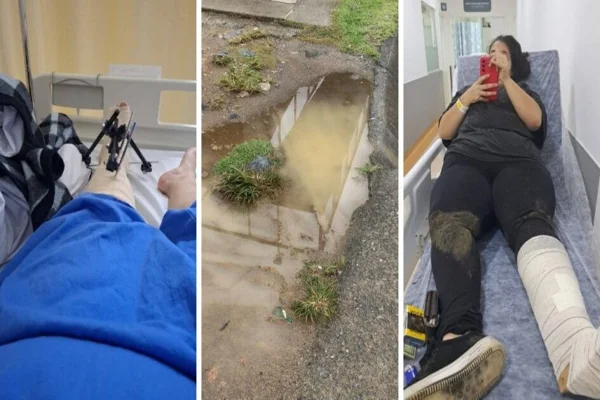 Imagem colorida, professora caiu em um buraco e precisou passar por três procedimentos- Metrópoles