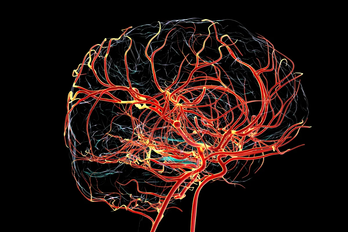 Alterações do Alzheimer surgem antes de falhas na memória