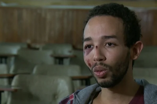 Jovem vai até delegacia denunciar furto e é espancado por ser gay