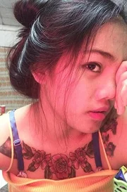 Garota relata momentos de dor ao remover tatuagem com método polêmico - imagem 3 Garota relata momentos de dor ao remover tatuagem com método polêmico - imagem 3