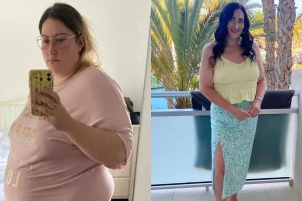 Mulher perde 70 kg após casamento ser adiado pela pandemia - destaque galeria