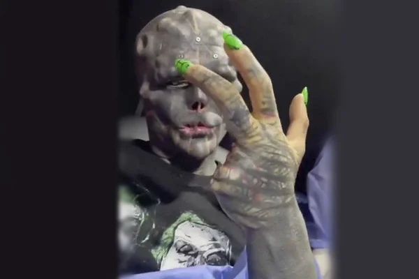 Homem corta dois dedos para se parecer com alienígena