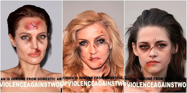 #BreakTheSilence: Famosas aparecem com “hematomas” em campanha contra abusos doméstico