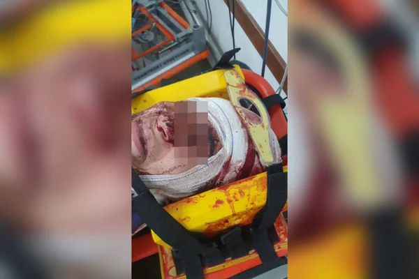 Homem é preso após tentar matar mulher com golpes de barra de ferro no DF
