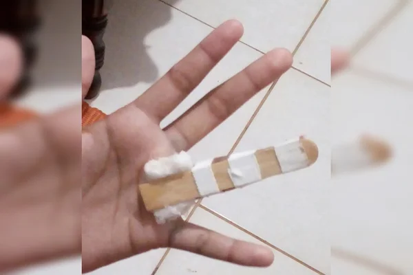Homem quebra dedo do sobrinho e ameaça irmã de morte no Entorno do DF
