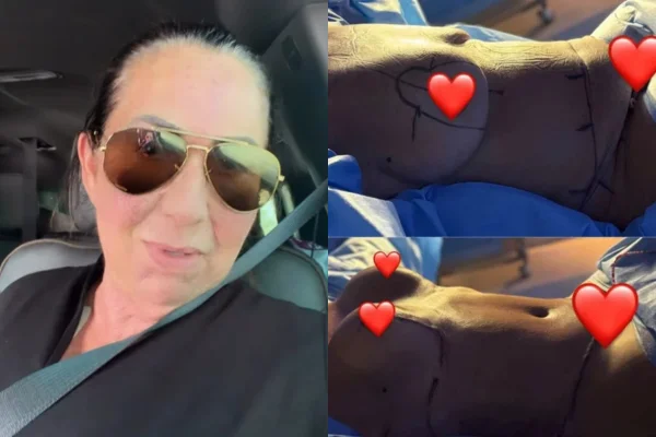 Mãe de Virginia recebe alta após plásticas: “Tudo maravilhoso”