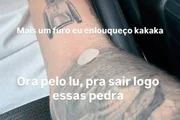 Luan Pereira falou sobre as agulhadas que vem tomando Luan Pereira falou sobre as agulhadas que vem tomando