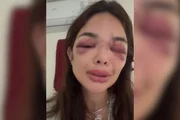 Giullia Kos acusa o marido, Ivo Kos, de agredí-la Giullia Kos acusa o marido, Ivo Kos, de agredí-la