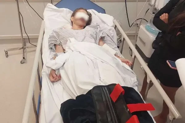 Imagem colorida, mulher em leito de hospital com rosto atingido - Metrópoles
