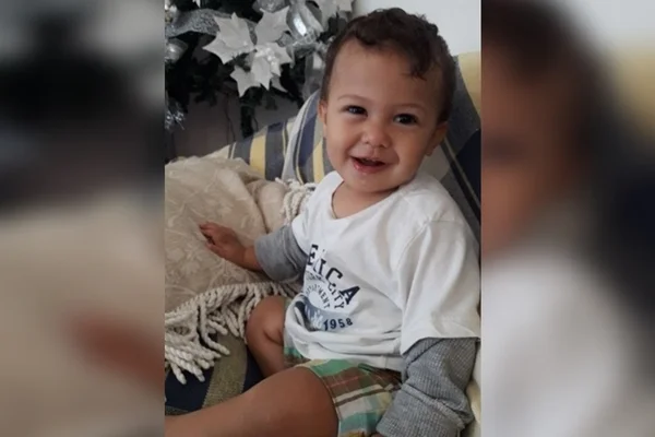 Menino de 1 ano tem rosto totalmente queimado por água fervente