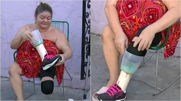 Imagem colorida de mulher usando uma prótese feita de copo de liquidificador e cano PVC - Metrópoles