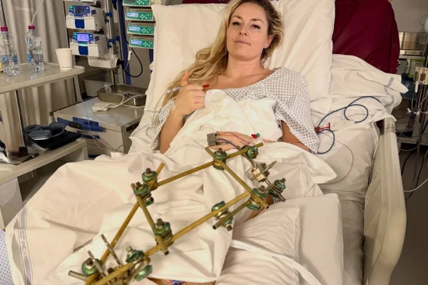 Lindsey Vonn revela drama após acidente: “Um passo da amputação” - destaque galeria Lindsey Vonn revela drama após acidente: “Um passo da amputação” - destaque galeria