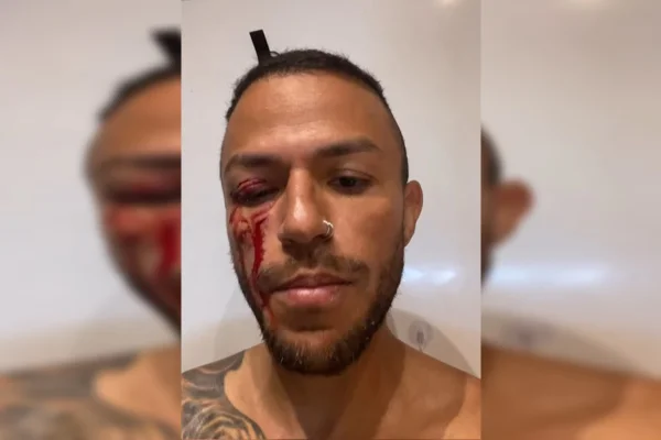 Imagem colorida de homem com rosto ensaguentado