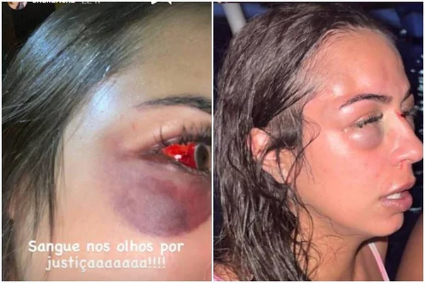 Arquiteta é vítima de agressão
