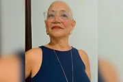 "Ter que raspar o cabelo é terrível. Sou vaidosa, amo escovar os cabelos, então foi algo extremamente difícil", contou Fátima "Ter que raspar o cabelo é terrível. Sou vaidosa, amo escovar os cabelos, então foi algo extremamente difícil", contou Fátima