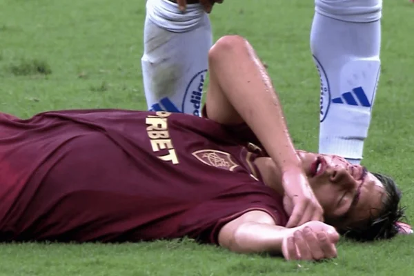 Bernal, do Fluminense, no chão ensanguentado
