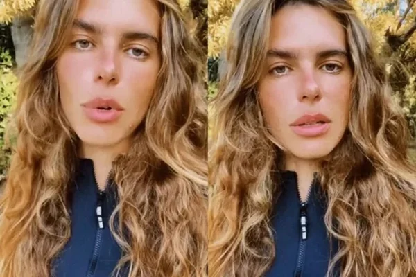 Mariana Goldfarb reclama e desabafa após sofrer ataque de pit-bulls