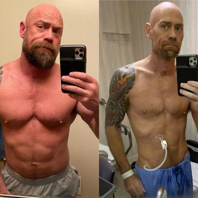 A foto do antes e depois do físico de Mike chocou o mundo A foto do antes e depois do físico de Mike chocou o mundo