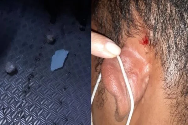 Cobrador de ônibus ferido por passageiro