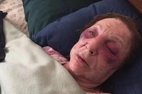 Idosa é agredida e roubada um dia antes de ir ao funeral do marido