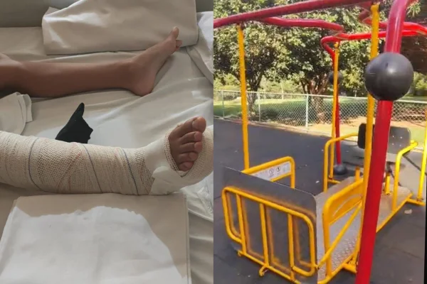 Menina de 9 anos quebra a perna em brinquedo de parque em Águas Claras