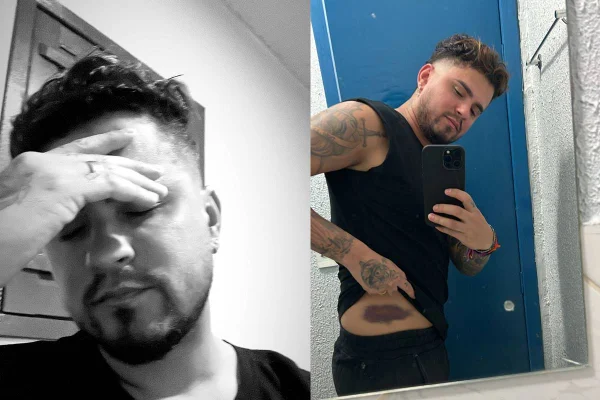 cantor sertanejo cai no palco durante gravação de DVD em goiânia e mostra machucado