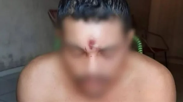 Jovem leva tiro na testa, cai da moto e vai para casa dormir