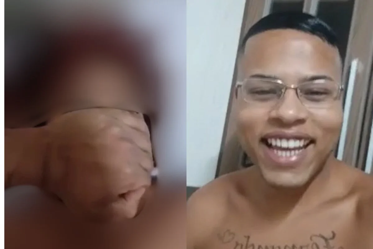 Vítima foi agredida fisicamente após abuso sexual Vítima foi agredida fisicamente após abuso sexual