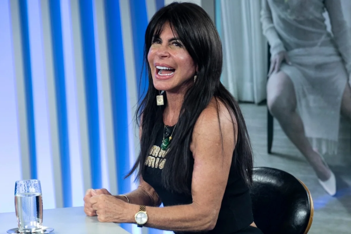 Gretchen tirou a peruca ao vivo e mostrou resultado de transplante capilar. Gretchen tirou a peruca ao vivo e mostrou resultado de transplante capilar.