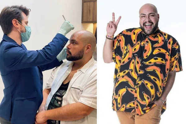 Saiba quais procedimentos estéticos Tiago Abravanel fez antes do BBB22