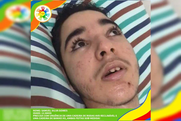 Menino que sofreu descarga elétrica precisa de cadeira de rodas
