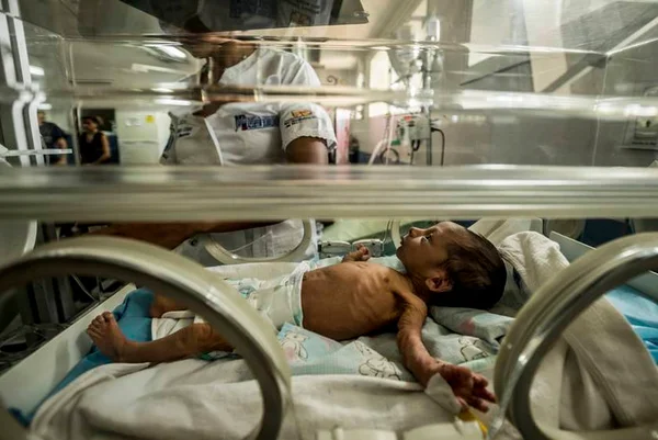 Unicef denuncia elevada desnutrição entre crianças na Venezuela