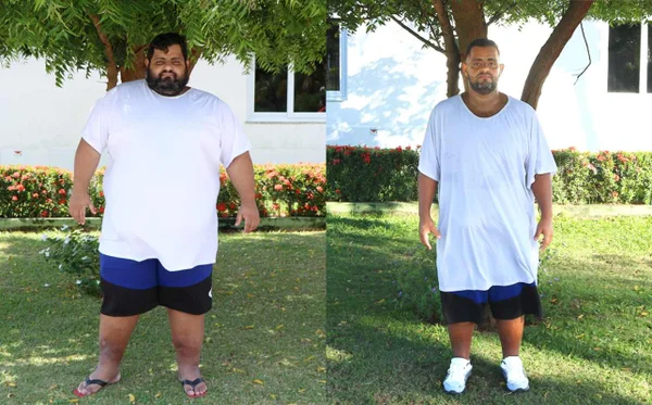 Comerciante perde 116kg em tratamento único no Hospital da Obesidade