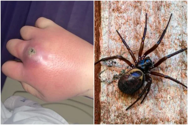 aranha