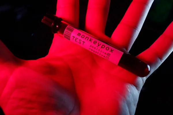 banco de imagem ampola e seringa teste variola macaco monkeypox saude doença