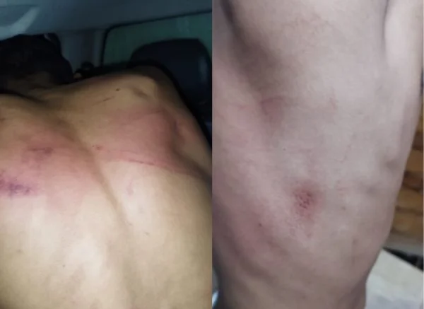 Vítima de tortura aciona PM e membro do Comando Vermelho é preso em MT