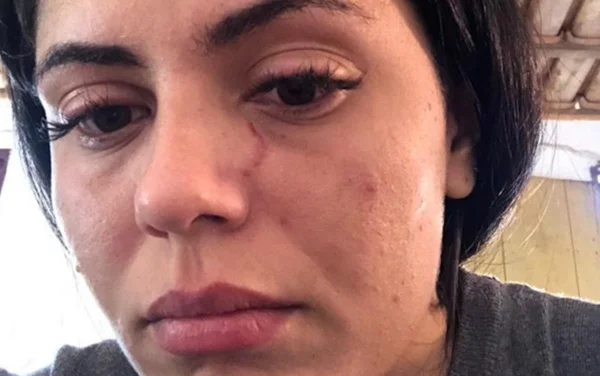 Empresária diz que foi agredida por ex após negar dinheiro para aposta