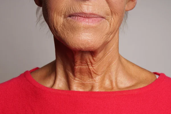 Foto colorida de mulher de blusa vermelha com rugas no pescoço - Metrópoles