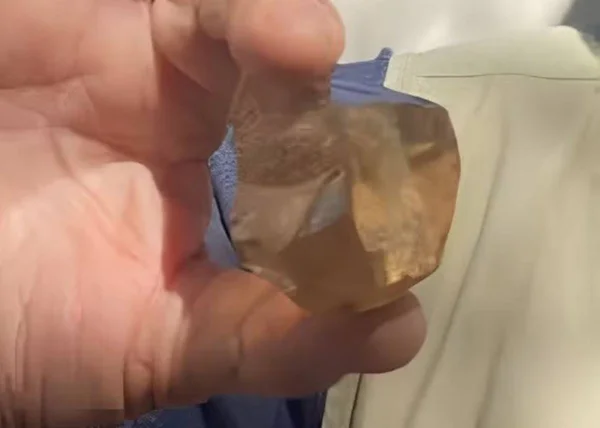 Pedra de R$ 16 mi: saiba de onde vieram os maiores diamantes do Brasil
