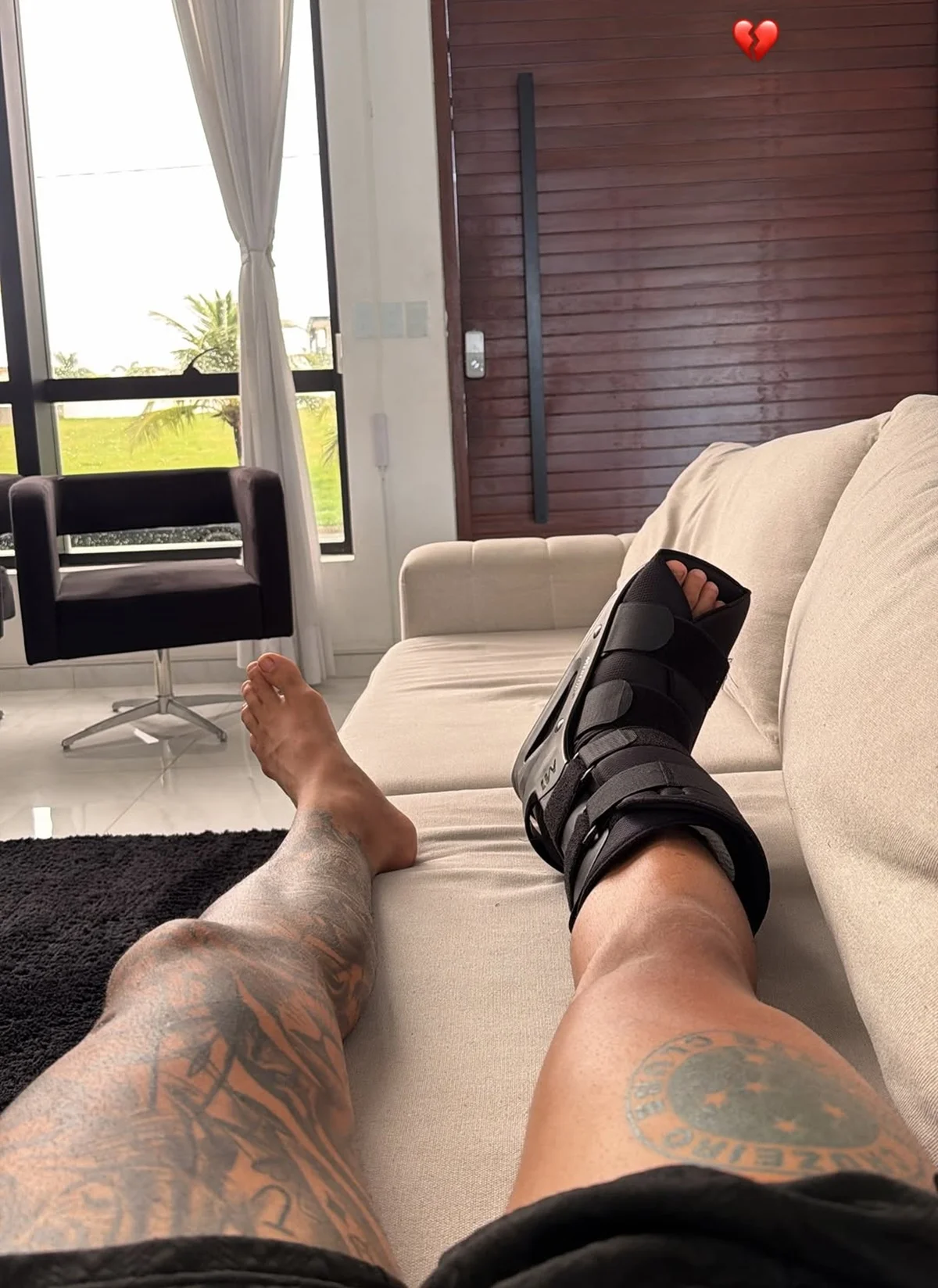Anderson Neiff mostrou o pé machucado Anderson Neiff mostrou o pé machucado