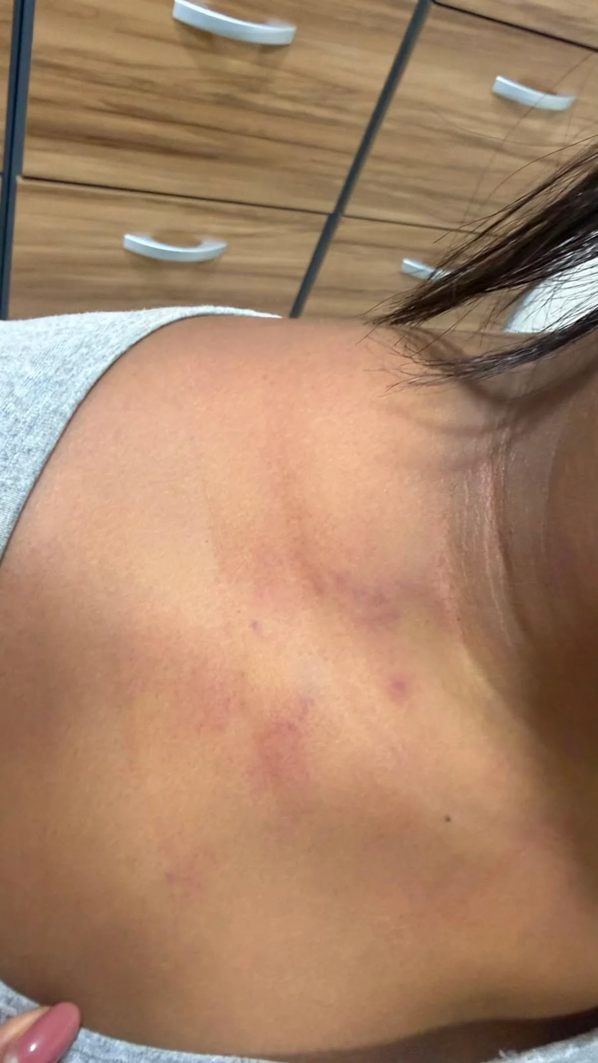 Ela levou socos, puxões de cabelo e foi esganada pelo autor do crime Ela levou socos, puxões de cabelo e foi esganada pelo autor do crime