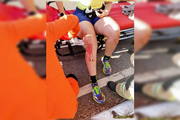 Mulher foi atacada por dez cachorros de rua enquanto corria na Asa Norte. Foto mostra ferimentos e sangue no joelho