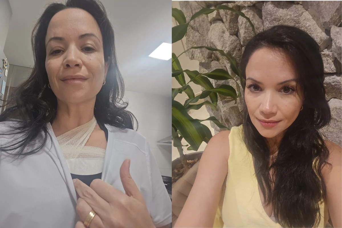 "Preciso viver o agora", diz psiquiatra que descobriu câncer de mama aos 45
